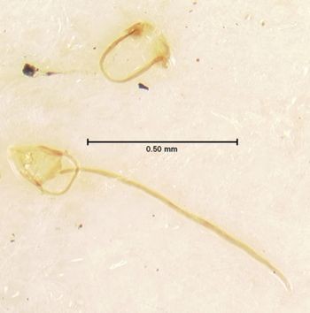 Media type: image;   Entomology 6787 Aspect: genitalia